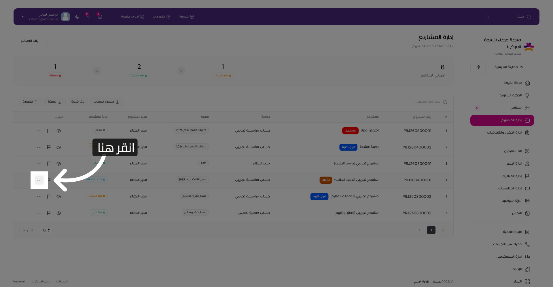 فتح خيارات المشروع